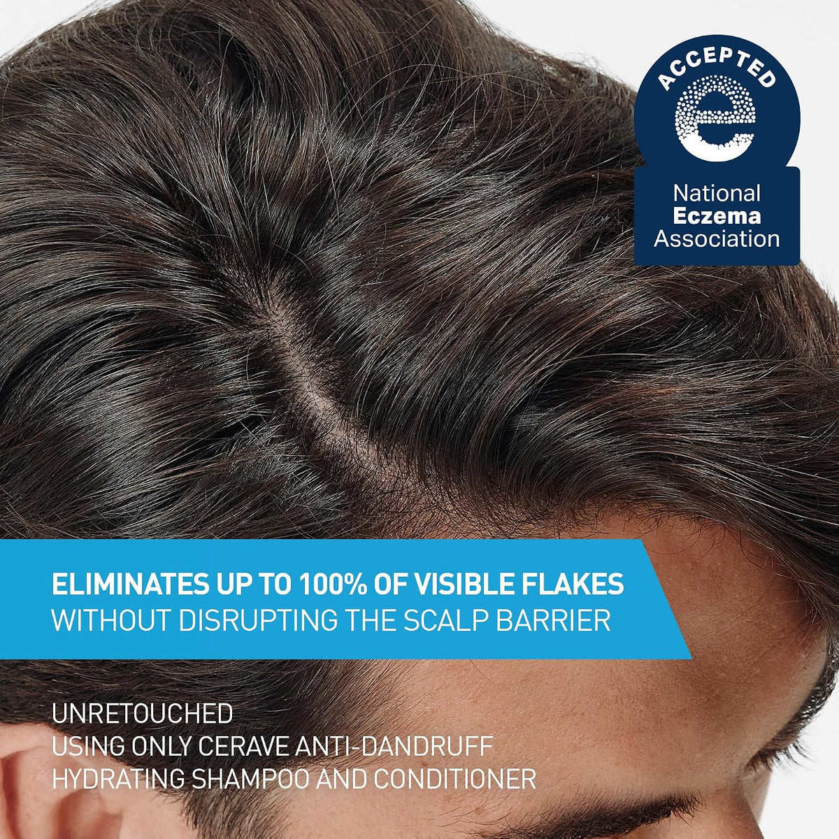 CeraVe Hydrating Anti Dandruff Shampoo. Itchy Scalp Treatment. 19oz | Helps Eliminate Flakes with 1% Pyrithione Zinc. Hyaluronic Acid. Niacinamide and Ceramides In A Sulfate Free Formula